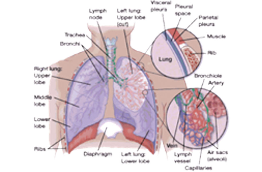 Non-Invasive Breast Cancers