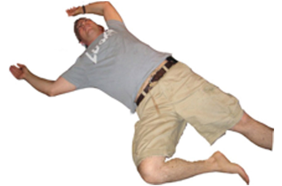 syncope-fainting-syncope