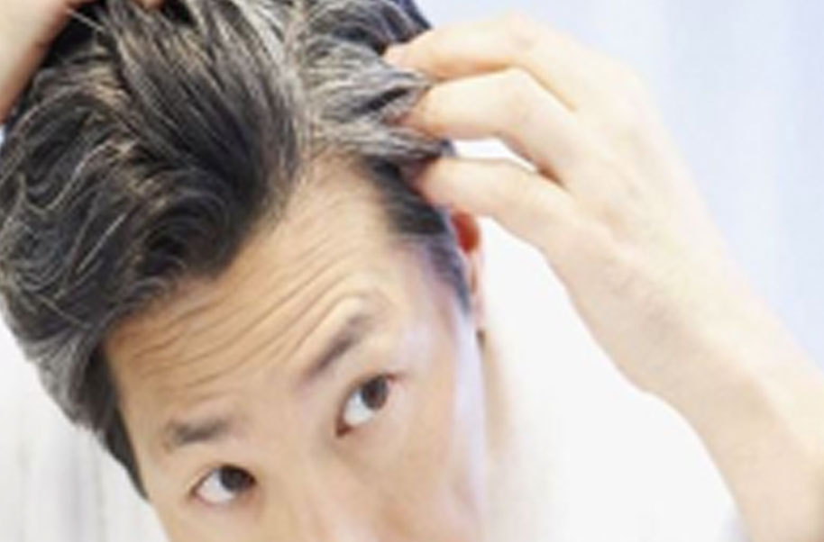 Premature Graying