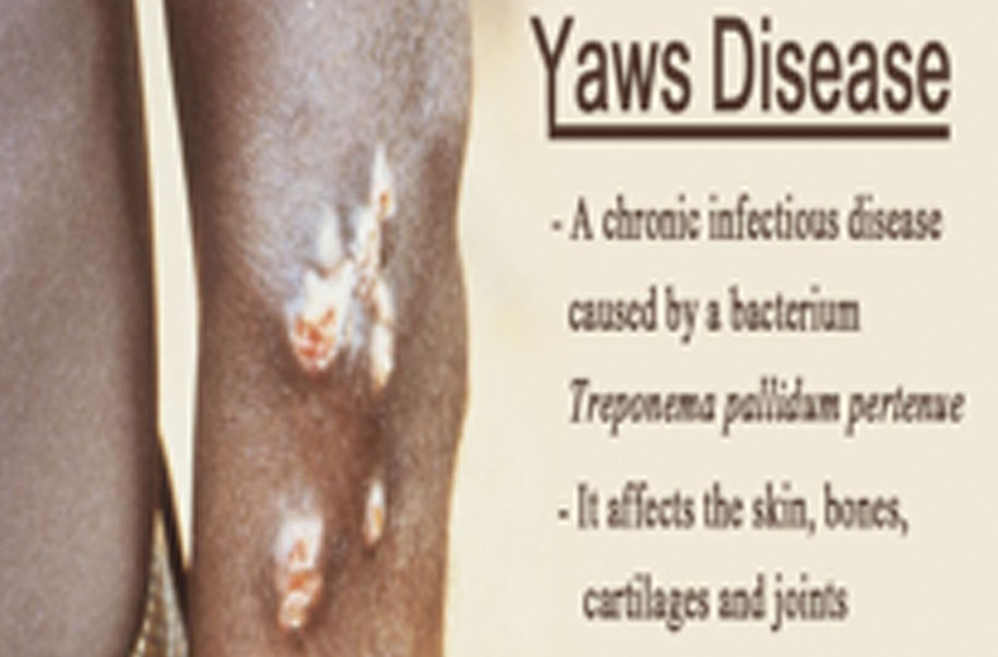 Frambesia Yaws Disease Frambesia Yaws Disease